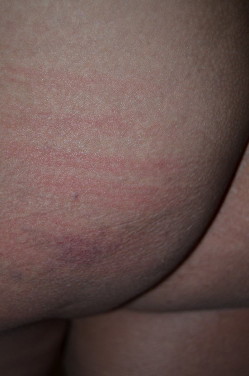 caning